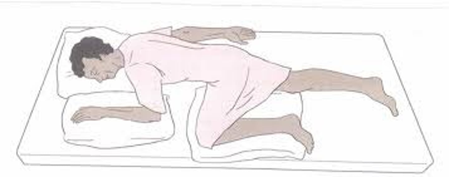 <p>laying on the left side with left leg slightly flexed and the right leg flexed at 90 degree angle; can involve pillow placed between the legs</p><p>exams involving the rectum, enemas</p>