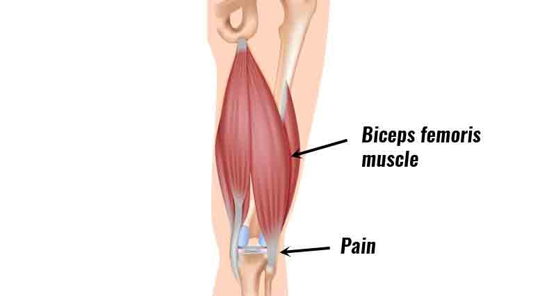 <p><mark data-color="#2c3079" style="background-color: rgb(44, 48, 121); color: inherit;">Posterior:</mark> Biceps femoris → flexes leg at knee.</p>