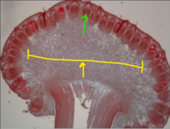 <p>Yellow arrow - name the entire structure</p>