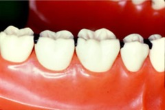<p>A "V" or wedge-shaped space</p>