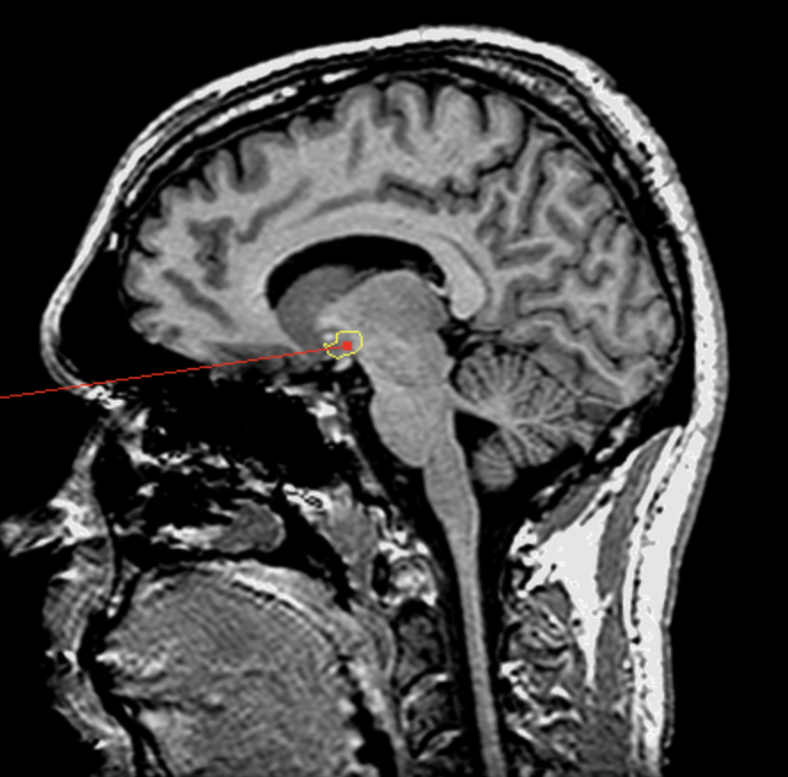<p>What is the area highlighted called?</p>