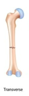 <p>TRANSVERSE</p>