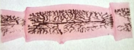 <p>What are the brown lines in this tapeworm proglottids?</p>
