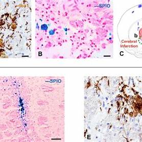 <p><em>IMAGE B </em></p><p><em>Tan, C., Shichinohe, H., Abumiya, T., et al. (2014). Turnbull blue-stained tissue in a rat model of lacunar infarction [Photomicrograph]. ResearchGate.</em></p>
