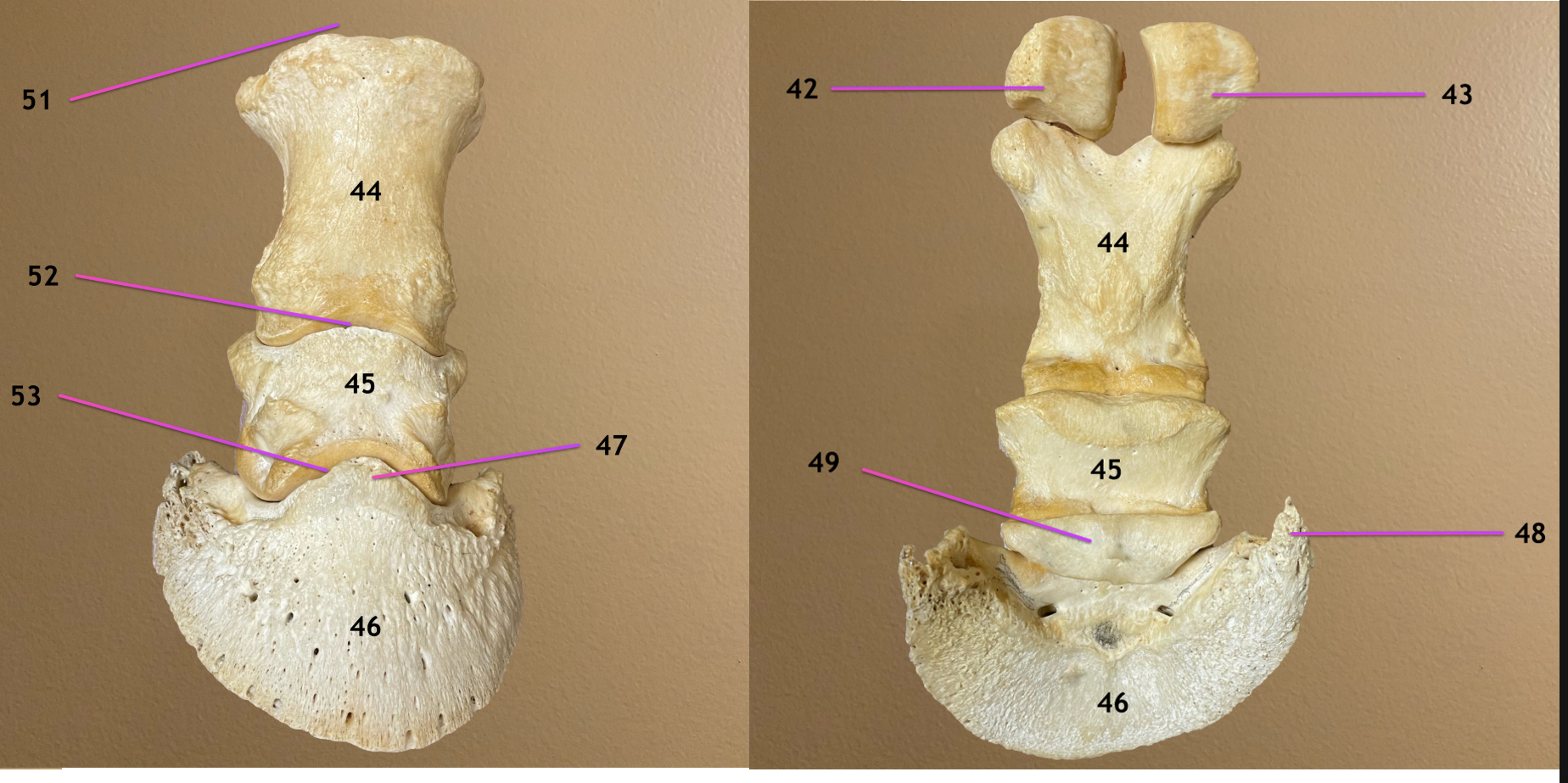 <p>left pic: dorsal view</p><p>rt pic: plantar view</p><p>.</p><p>label 49, 51-53</p><p>include anatomical &amp; common name for 51-53</p>