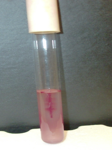 <p>In an inoculated TTC tube, “fuzziness” or “feathering”, especially away from the line of inoculation, would indicate ________.</p>