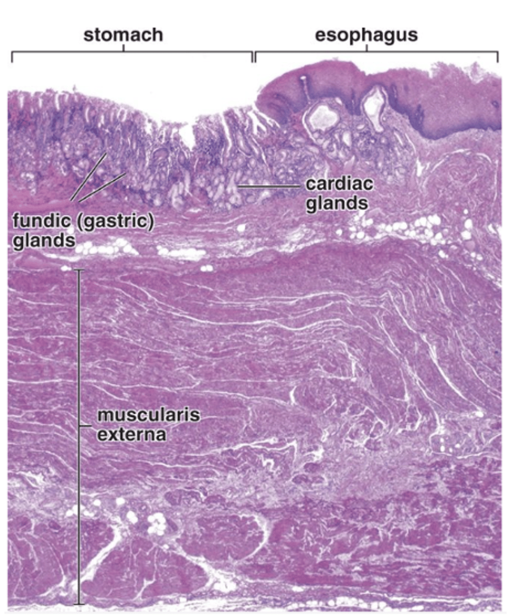 <p>What lymphoid cells are present in the lamina propria of the stomach? </p>
