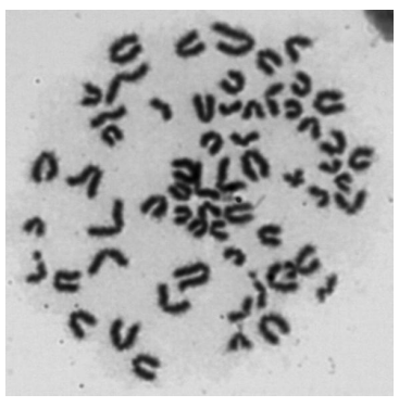 <p>Wskaż chromosomy, w których doszło do pęknięć/złamań chromatynowych.</p>