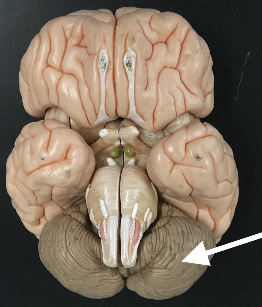 <p>What are the brown folds the arrow is pointing to?</p>