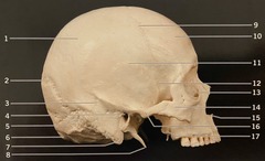 <p>What structure is #11? (Fig. 3.3 Cranium, Lateral View)</p>