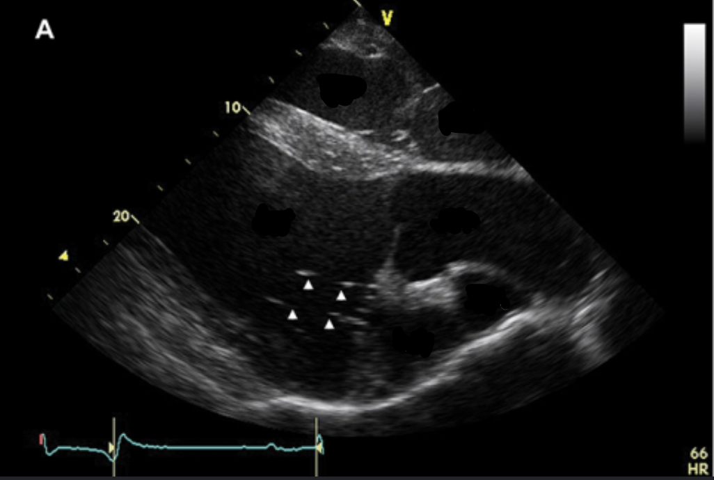 <p>Label the for chambers of the ultrasound image, the AV valves, the cardiac base, and the apex</p>