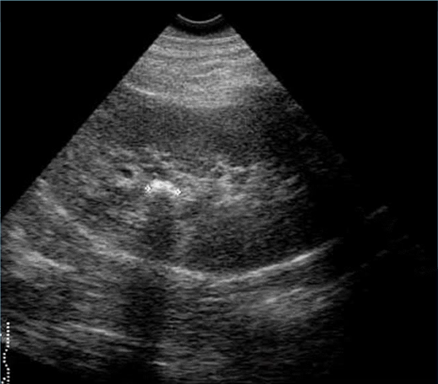 <p>what pathology is this </p>