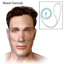 <p>what’s the highest rate a nasal canulla can give oxygen?</p>