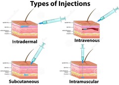 <p>A method where drugs are injected into a muscle.</p>