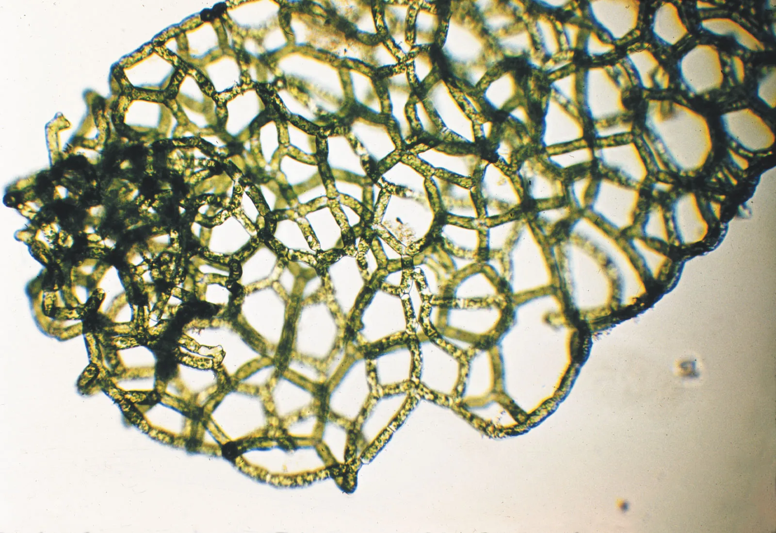 <p>Identify the genus of this Chlorophyta green algae.</p>