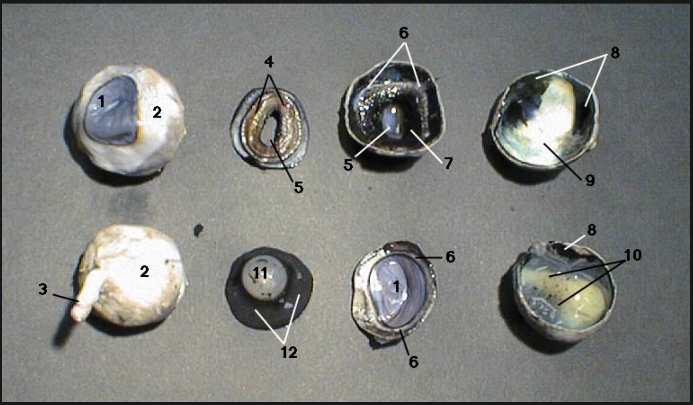 <p>(PARTS OF THE EYE) Identify all numbered:</p>
