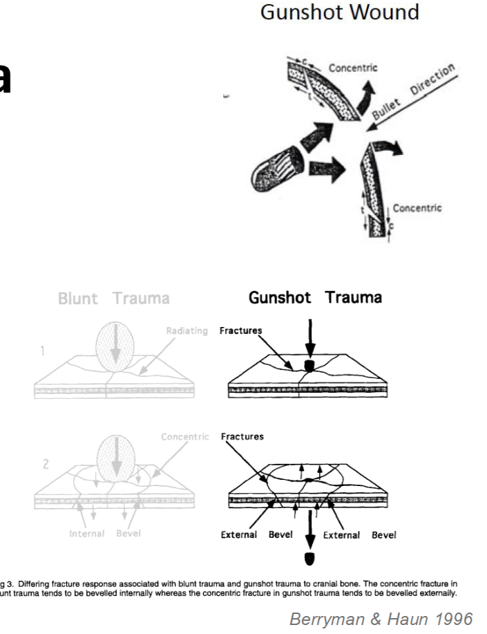 <p>Projectile/Ballistic Trauma</p>