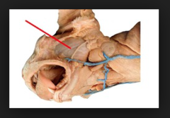 <p>muscle that serves to elevate the mandible</p>