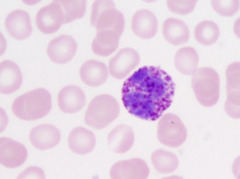 <p>A round WBC filled with coarse, dark blue to purple-black cytoplasmic granules that often hide the underlying 2-lobed or S-shaped nucleus</p>