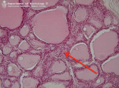 <p>surrounding follicle cells in <strong>thyroid</strong></p>