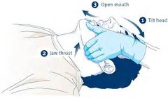 <p>Head tilt, jaw thrust, chin lift</p>