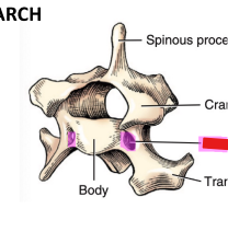 <p>Q: In the vertebral arch, at the root of each transverse process in the cervical region EXCEPT C7 is the …… </p><p>A. Transverse foramen </p><p>B. Lateral vertebral foramen </p><p>C. Alar foramen </p><p>D. Dorsal sacral foramen</p>