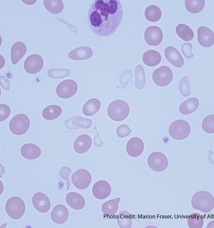 <p>what anemia is this?</p>