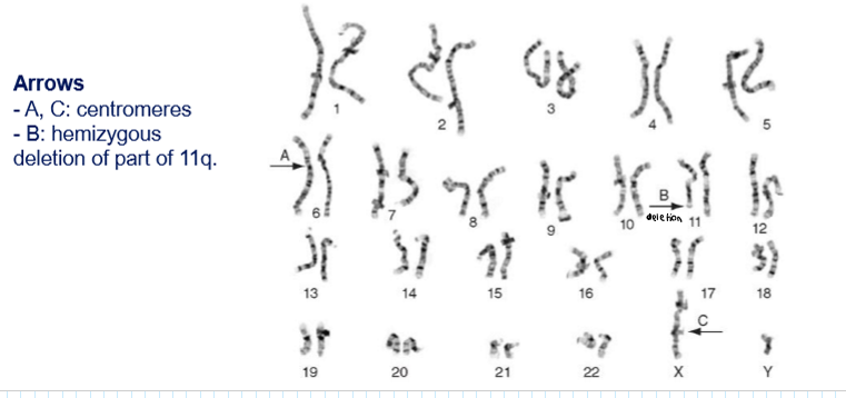 <p>They provide structural organization of individual genomes → you can detect deletions, insertions, duplications, translocations of large DNA fragments (you can detect big mutations)</p>