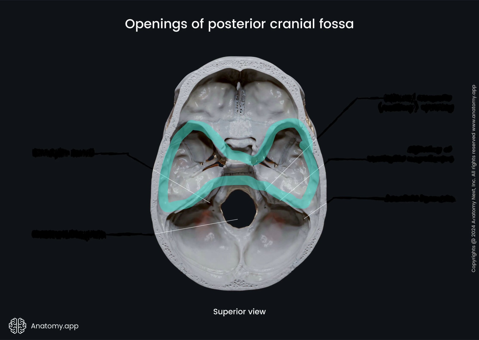 <p>What is the highlighted bony landmark</p>