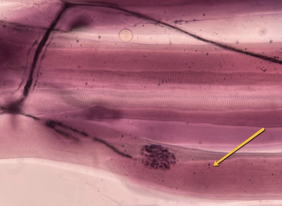 <p><span>Identify the cell indicated by the pointer.</span></p>