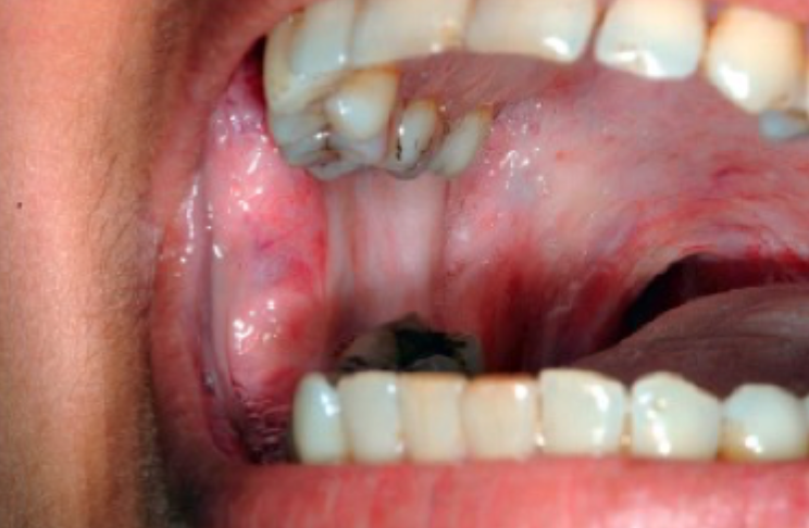 <p>what is this condition</p>