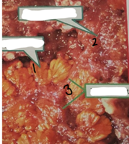 <p>point 3 on this sea star</p>