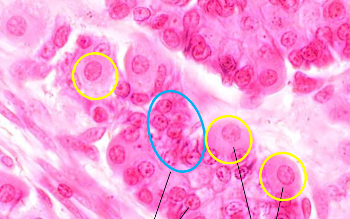 <p>basofiel en eosinofiel</p>