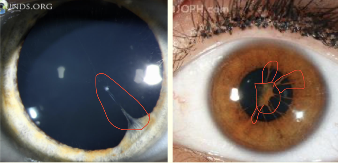 <p>Describe this image and give a diagnosis </p>