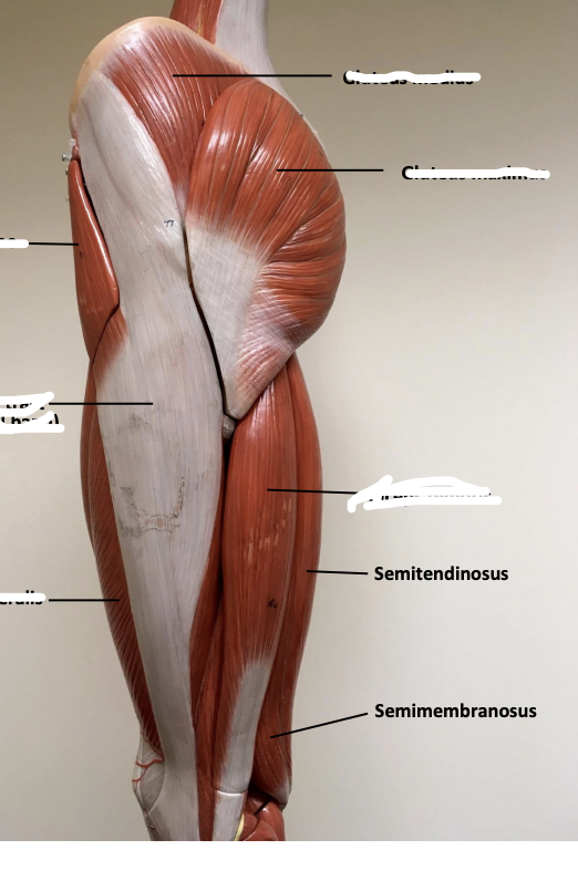 <p>Semimembranosus</p>