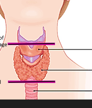 <p>ID from superior to inferior</p>