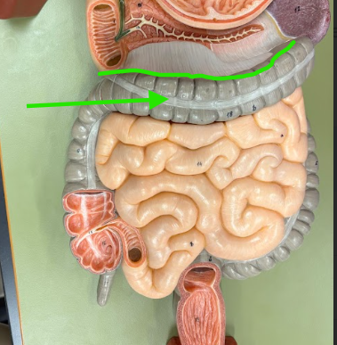 <p>What is the arrow pointing at?</p>