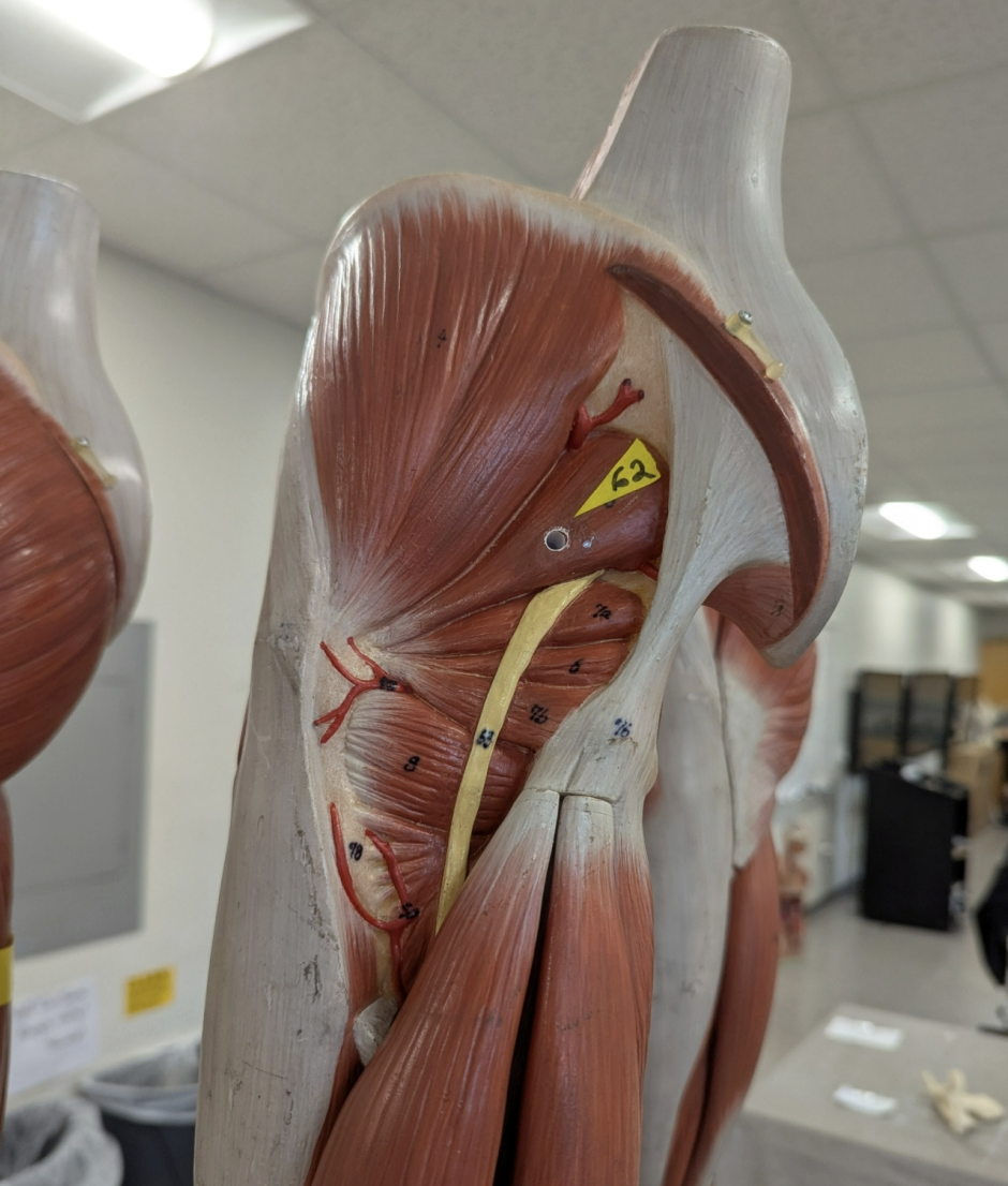 <p>what muscle is this (1)</p><p><strong>origin, insertion, action, innervation?</strong></p>