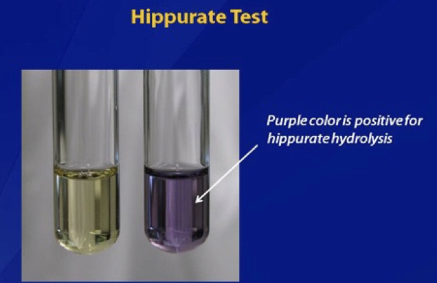 <p>Liquid broth test for identification of GBS. The tube on the right is positive for Group B = purple</p>