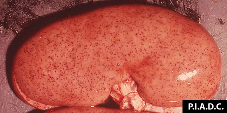 <p>"Turkey-egg" Kidneys</p>