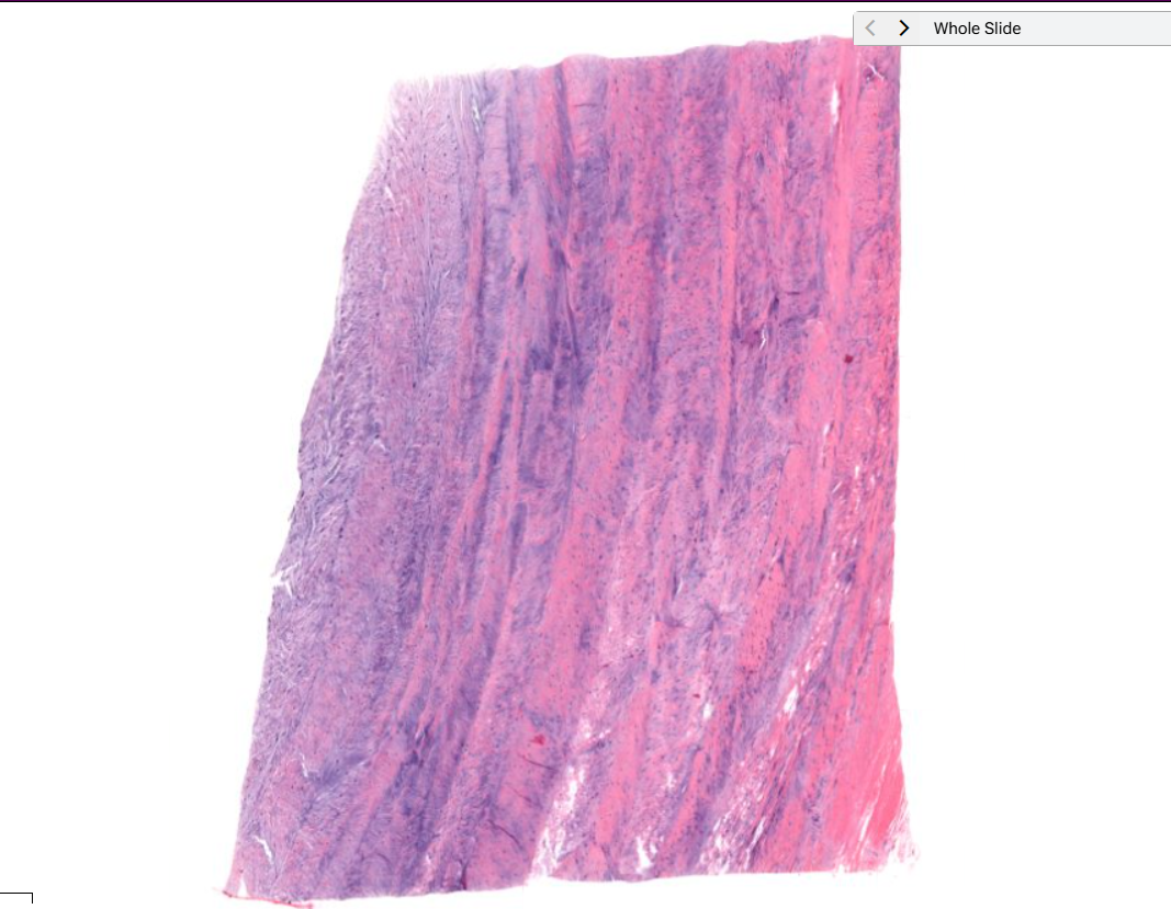 <p>What tissue type is present?</p>