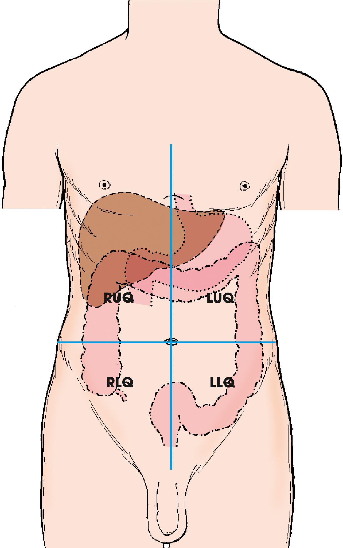 <p>Right upper quadrant (RUQ)</p><p>Right lower quadrant (RLQ)</p><p>Left upper quadrant (LUQ)</p><p>Left lower quadrant (LLQ)</p>