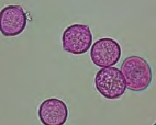 <p>Type of pollen? </p>