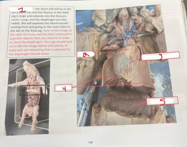 <p>Thoracic Cavity</p>