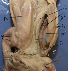 <p>E</p>