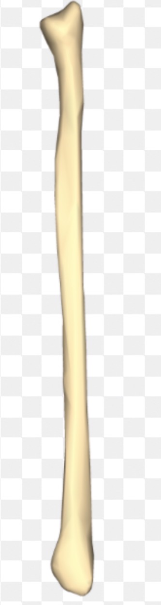 <p>What side of the fibula is this?</p>
