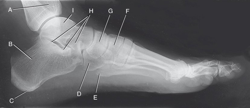 <p>Label G</p>