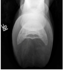 <p>what is it if radiographs are normal and you thought it was NB disease</p>