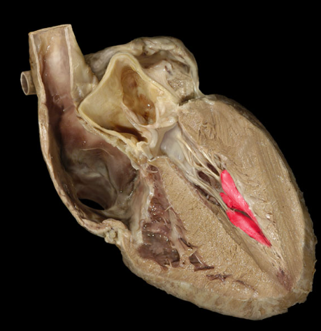 term image