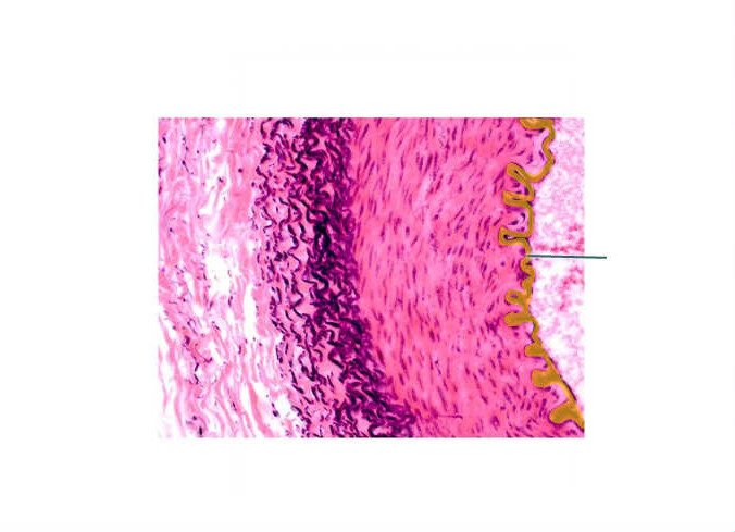 <p>the innermost layer of a blood vessel, composed of a single layer of squamous epithelial cells over a sheet of connective tissue; its smooth, frictionless surface allows blood to flow smoothly through the vessel</p>